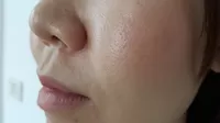 ¿Se pueden cerrar o hacer menos visibles los poros abiertos de la cara?